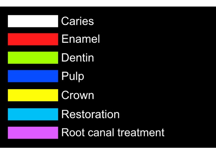 Intelligent Dental Assistant Tells the Tooth – screenshot 2