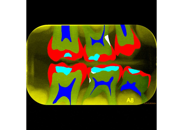 Intelligent Dental Assistant Tells the Tooth – screenshot 1