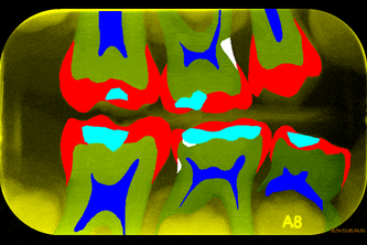 Intelligent Dental Assistant Tells the Tooth