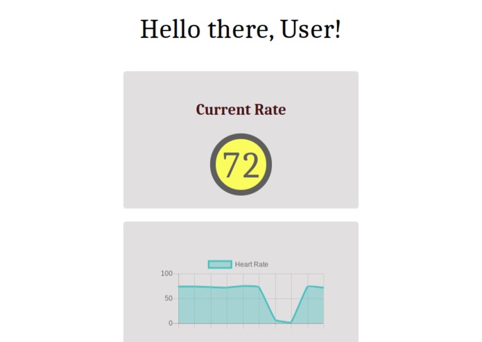 Mood Ring: a heart rate tracker for anxiety – screenshot 6