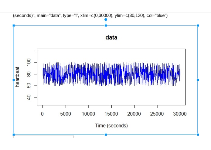 Mood Ring: a heart rate tracker for anxiety – screenshot 13
