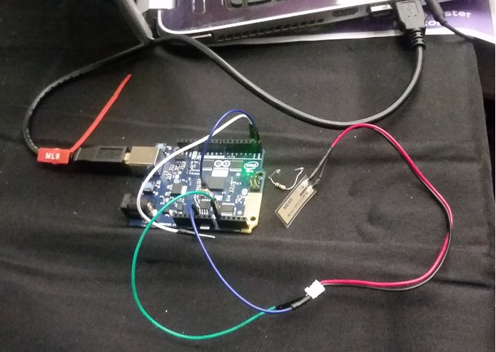 Mood Ring: a heart rate tracker for anxiety – screenshot 12