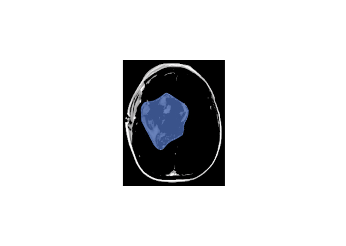 Medical Image Processing  – screenshot 1