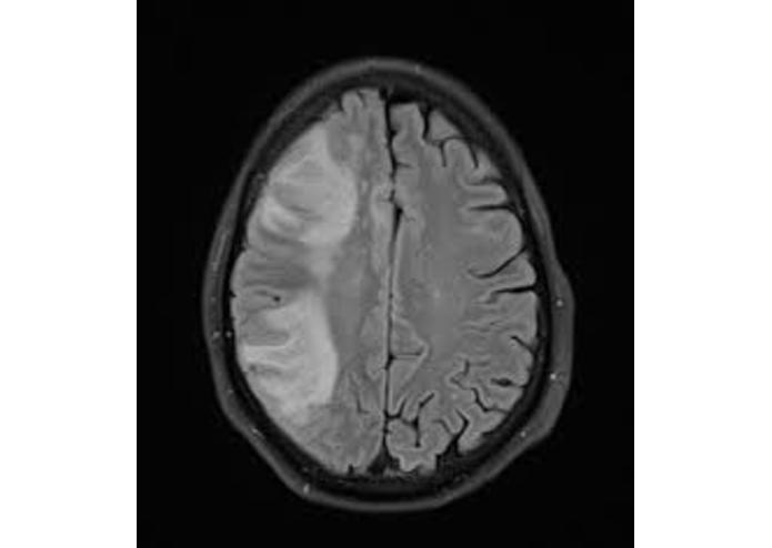 AlzheimerAnalyzer – screenshot 1