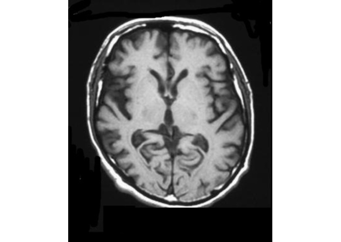 AlzheimerAnalyzer – screenshot 3