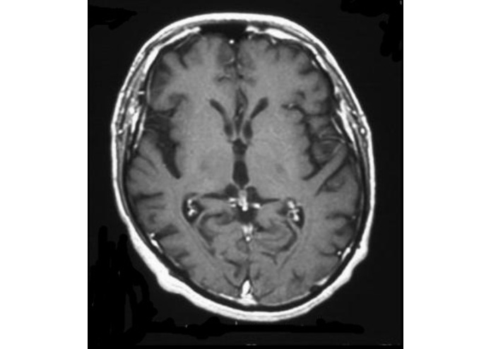 AlzheimerAnalyzer – screenshot 4