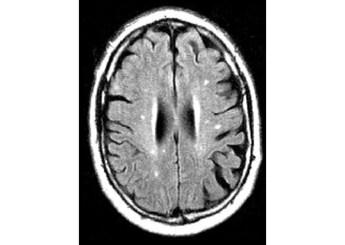 AlzheimerAnalyzer – screenshot 5
