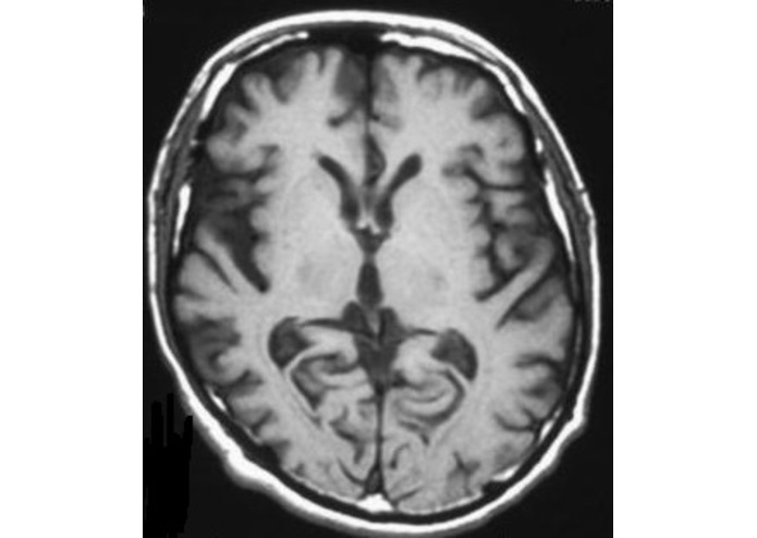 AlzheimerAnalyzer – screenshot 6