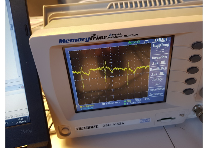 Heartbeat – screenshot 1