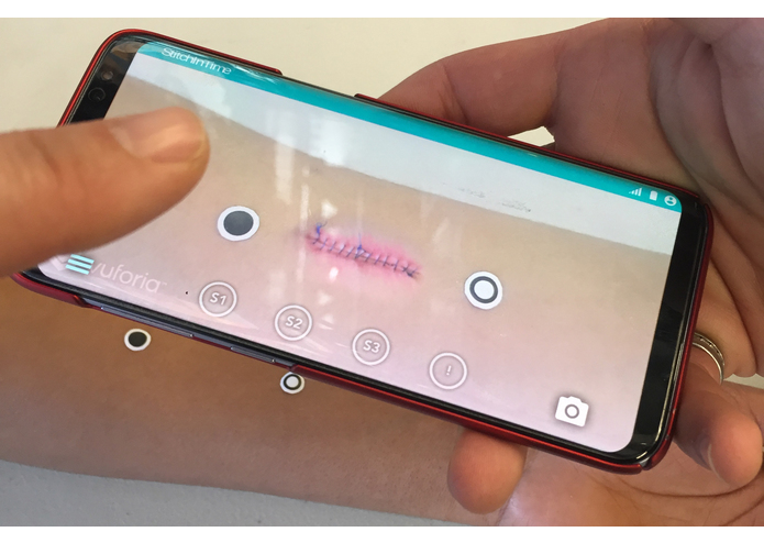 StitchInTime – screenshot 4