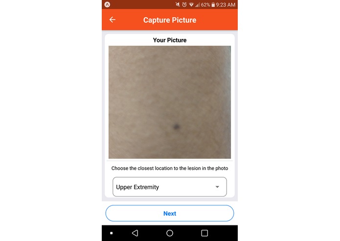 TumorVision – screenshot 3