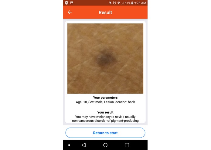 TumorVision – screenshot 4