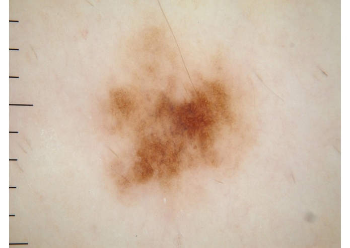 MelClassify – screenshot 1