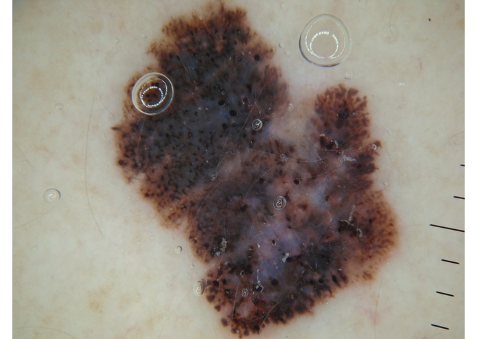 MelClassify – screenshot 2