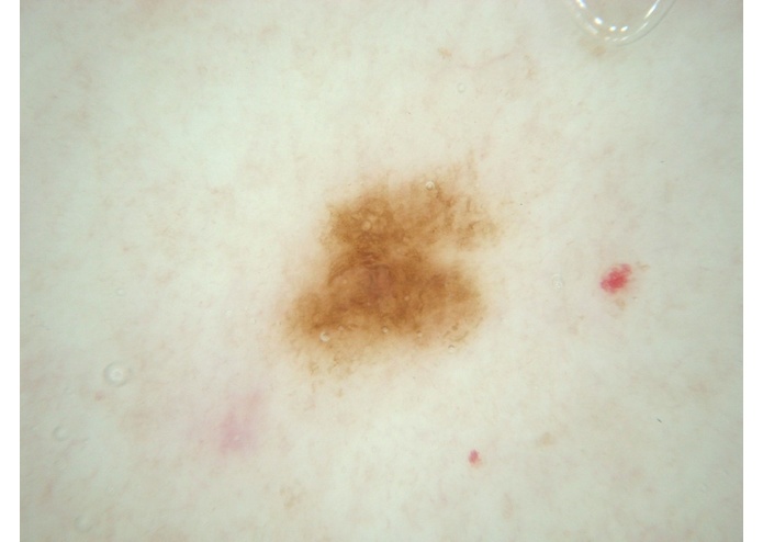 MelClassify – screenshot 3