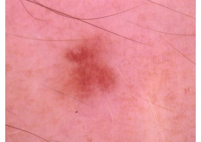 MelClassify – screenshot 4