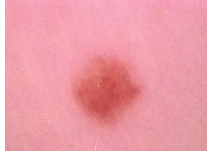 MelClassify – screenshot 7