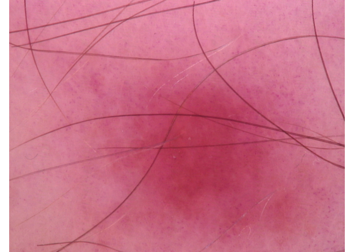 MelClassify – screenshot 8