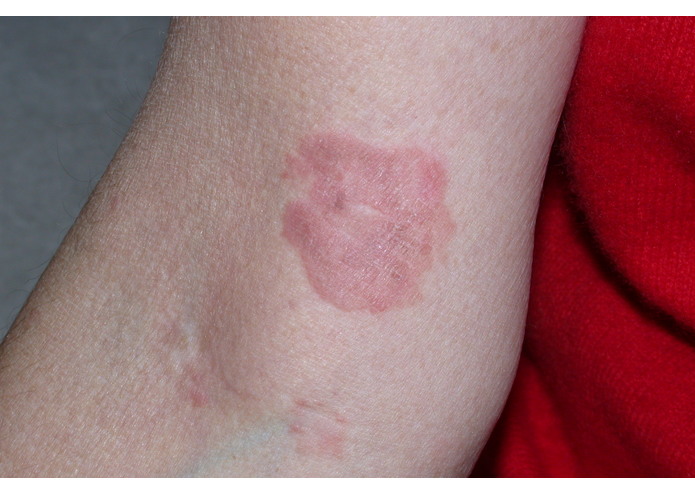 MelClassify – screenshot 10