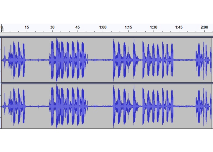 Goodnight - Sleep Apnea Detection App – screenshot 2