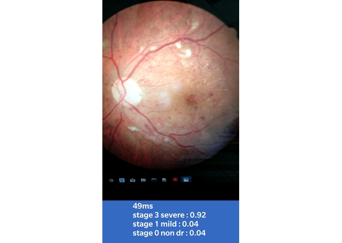 Duck that Diabetes – screenshot 3