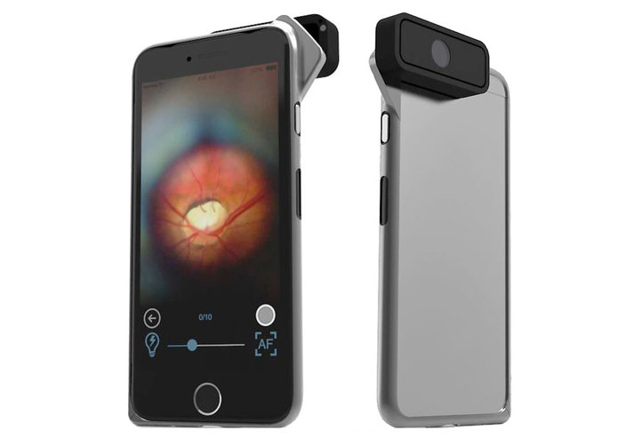 Noninvasive Bloodglucose Prediction via Fundus Imagery – screenshot 2