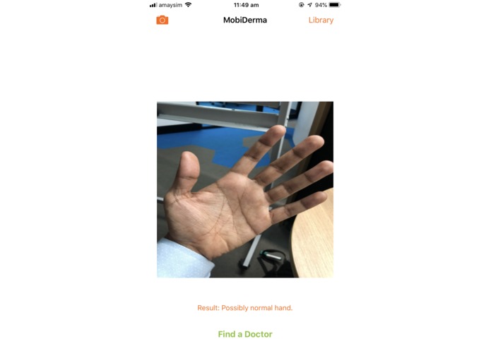 MobiDerma- Skin Condition Detection  – screenshot 2