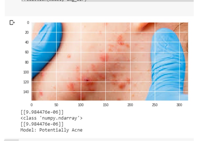MobiDerma- Skin Condition Detection  – screenshot 3