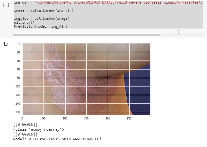 MobiDerma- Skin Condition Detection  – screenshot 4