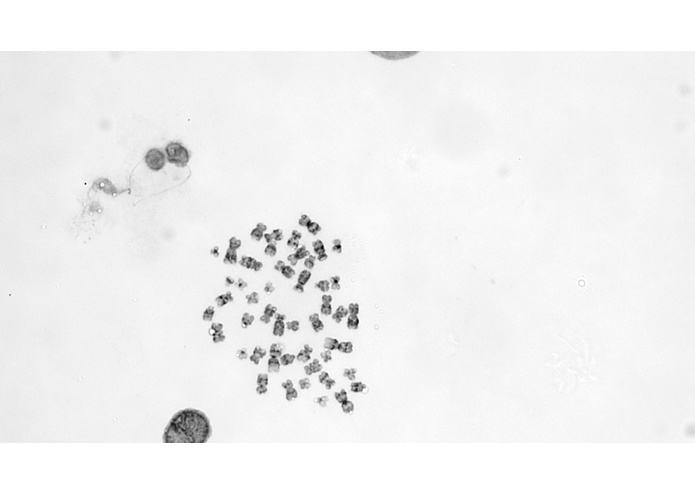 Automatic Karyotyping System – screenshot 1