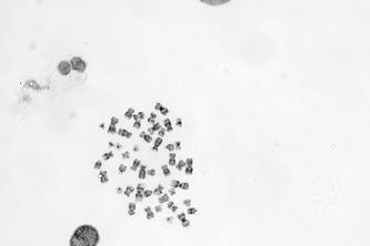 Automatic Karyotyping System