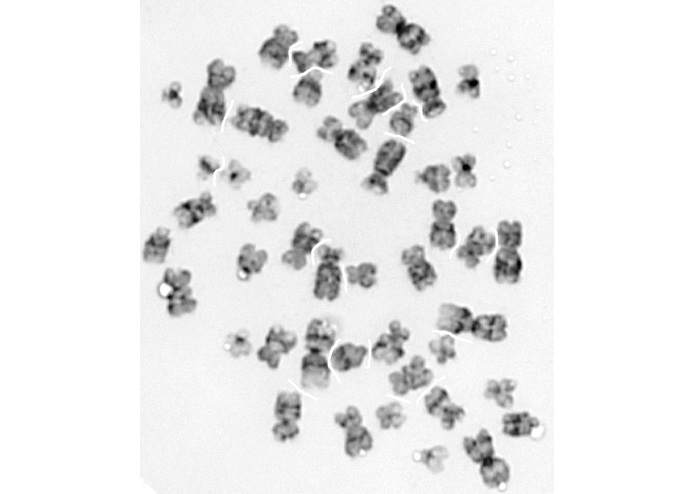 Automatic Karyotyping System – screenshot 2
