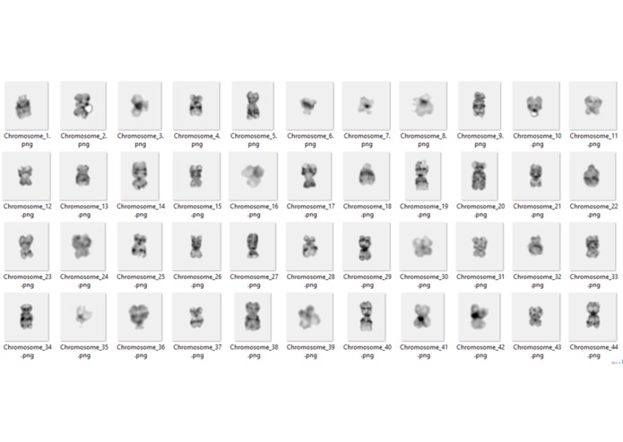 Automatic Karyotyping System – screenshot 3