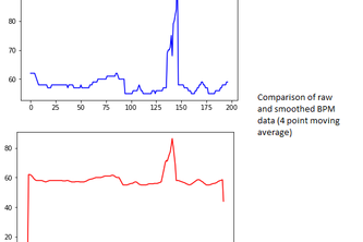 Child Seizure Monitor