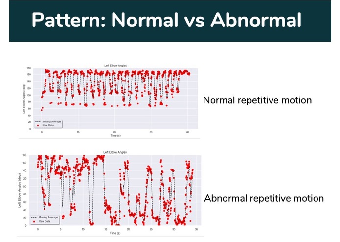 Team 11 Spring Bilateral Limb Assessment Technology – screenshot 22