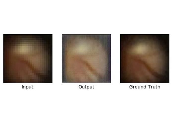 Noninvasive Bloodglucose Prediction via Fundus Imagery – screenshot 5