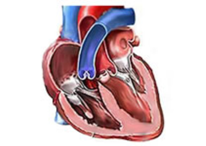 CardiacDetec – screenshot 1