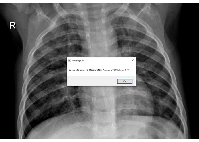 Automating Pneumonia Diagnosis Process Using UIPath & Keras – screenshot 1