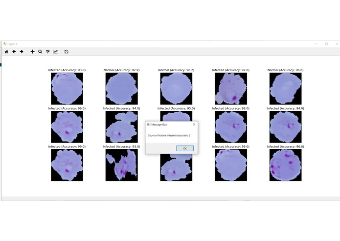 Automating Malaria Diagnosis Process Using UIPath & Keras – screenshot 1
