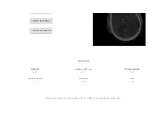 IHIT: Intracranial Hemorrhage Imaging Tool – screenshot 4