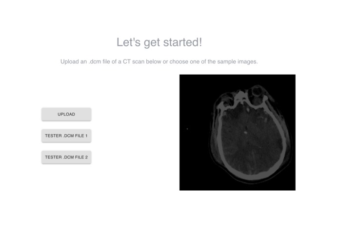 IHIT: Intracranial Hemorrhage Imaging Tool – screenshot 6