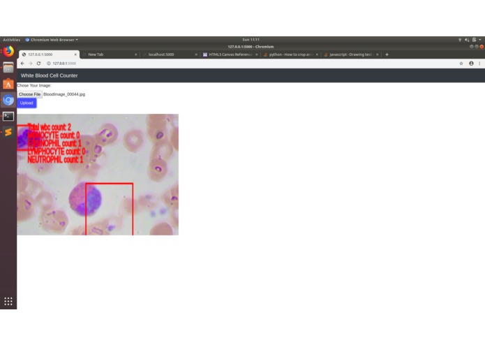 Online White Blood Cell Detection and Counting – screenshot 3