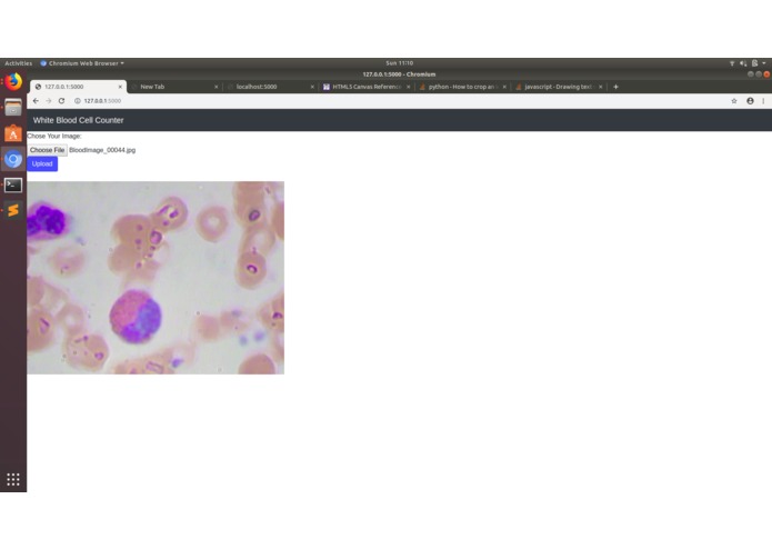 Online White Blood Cell Detection and Counting – screenshot 2