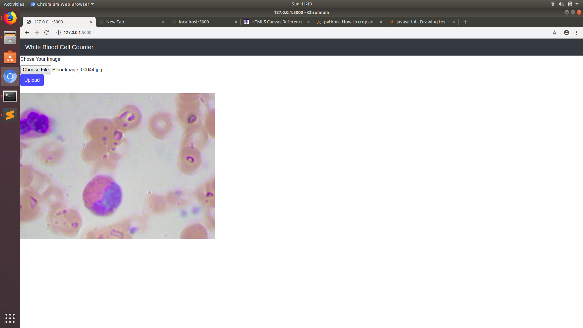 Online White Blood Cell Detection and Counting | Devpost