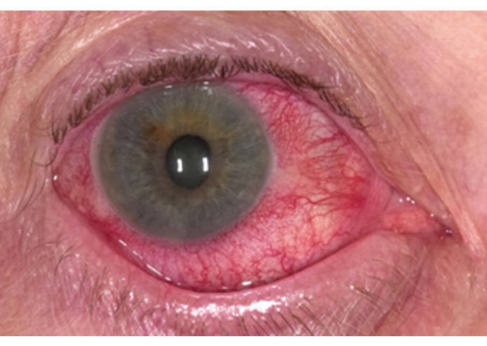 Eye Disease AI – screenshot 2