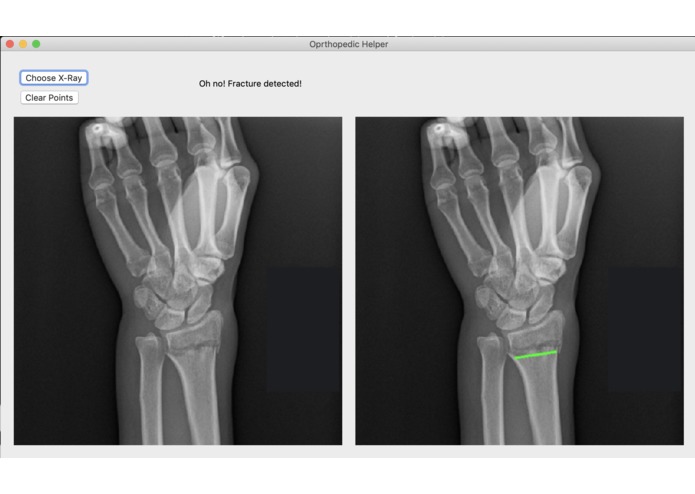 Broke Detector – screenshot 2