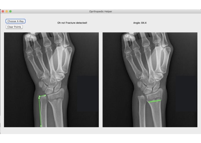 Broke Detector – screenshot 3