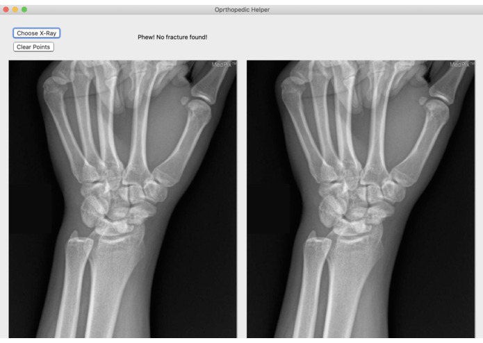 Broke Detector – screenshot 4