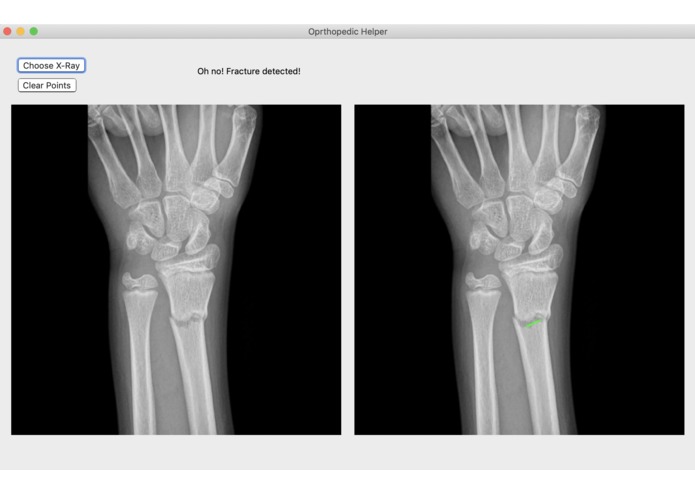 Broke Detector – screenshot 5