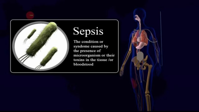 sepsis predictor – screenshot 1